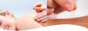 acupuncture-banner